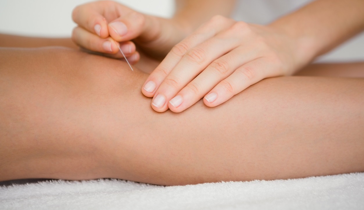Painful knees? What about acupuncture?