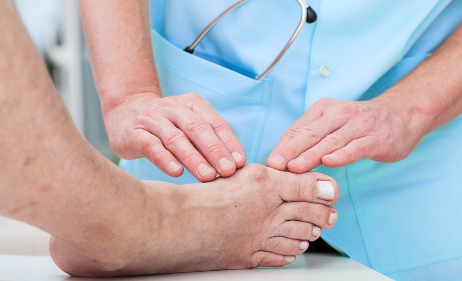 Older adult having their bunion inspected by a healthcare provider.
